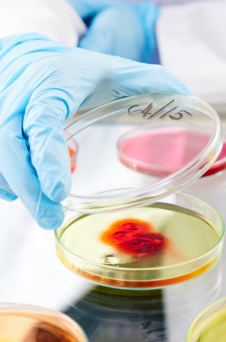 causas-de-las-enfermedades-infecciosas