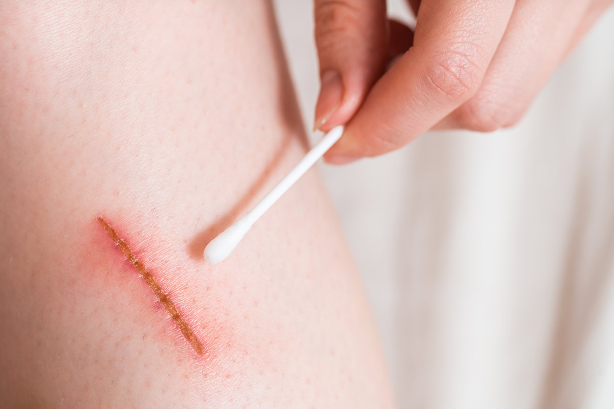 enfermedades-dermatologicas